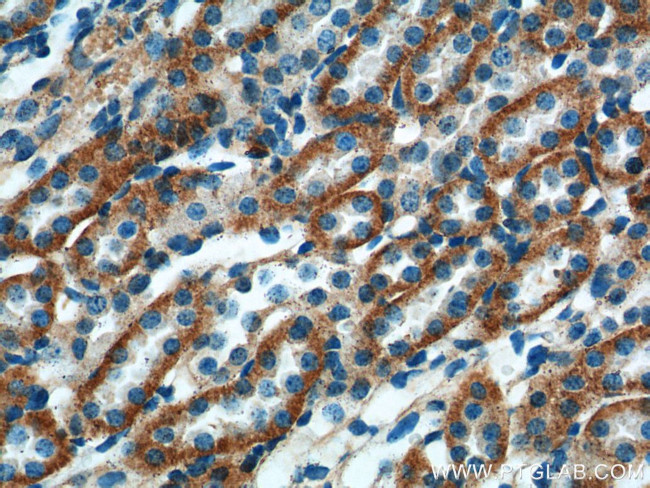 TXNIP Antibody in Immunohistochemistry (Paraffin) (IHC (P))