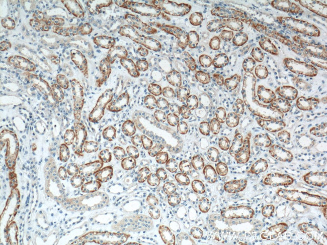 TXNIP Antibody in Immunohistochemistry (Paraffin) (IHC (P))