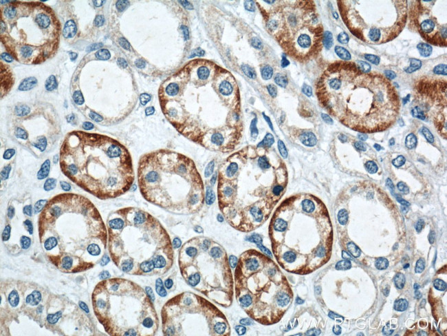 TXNIP Antibody in Immunohistochemistry (Paraffin) (IHC (P))