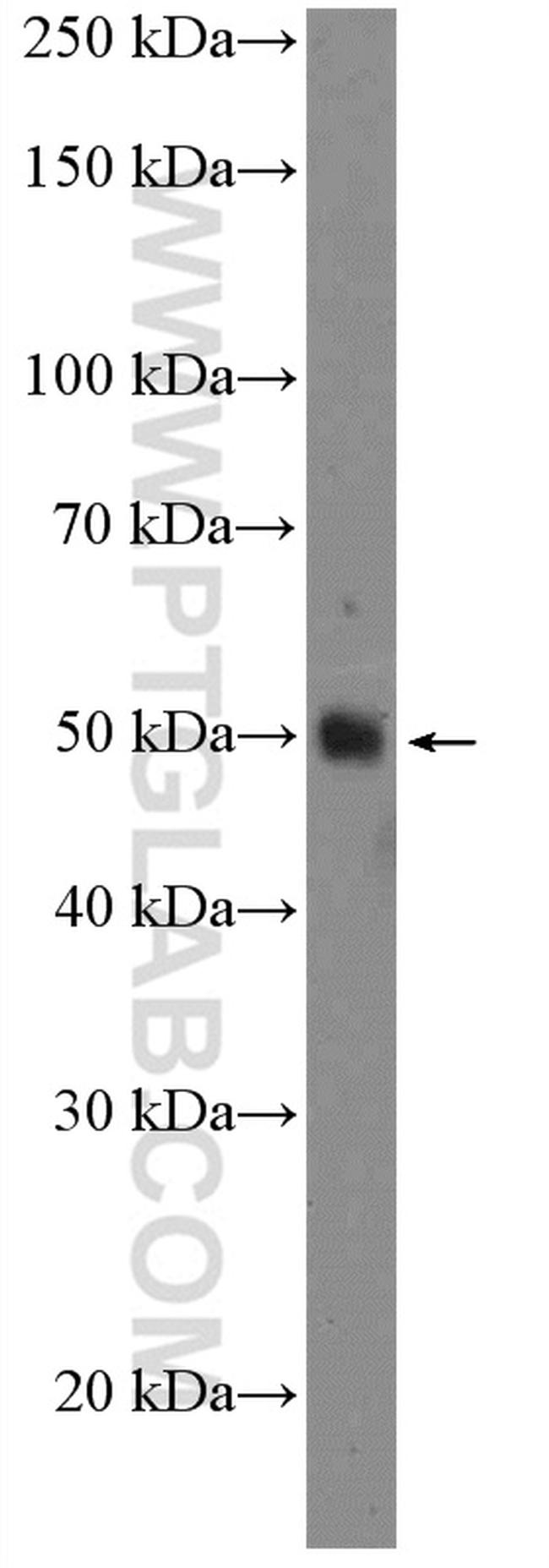 TXNIP Antibody in Western Blot (WB)