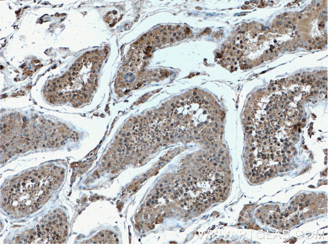 EIF2AK2/PKR Antibody in Immunohistochemistry (Paraffin) (IHC (P))