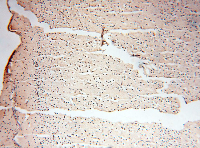 EIF2AK2/PKR Antibody in Immunohistochemistry (Paraffin) (IHC (P))