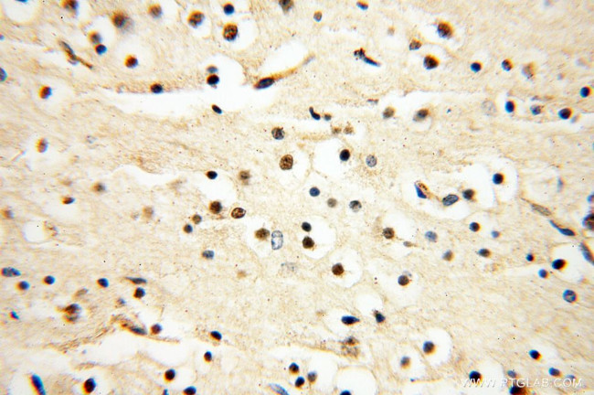 EIF2AK2/PKR Antibody in Immunohistochemistry (Paraffin) (IHC (P))