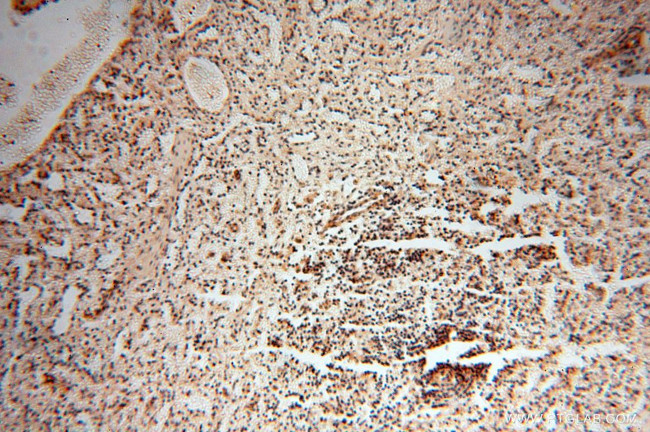 EIF2AK2/PKR Antibody in Immunohistochemistry (Paraffin) (IHC (P))