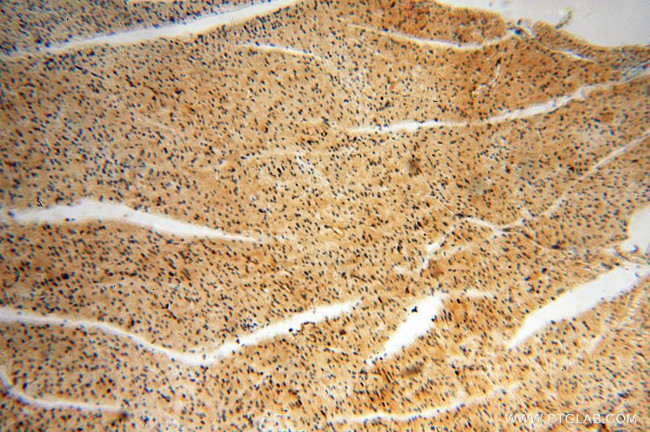 EIF2AK2/PKR Antibody in Immunohistochemistry (Paraffin) (IHC (P))