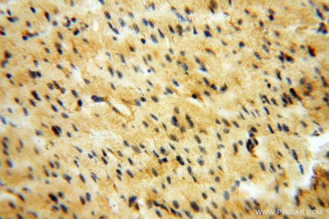 EIF2AK2/PKR Antibody in Immunohistochemistry (Paraffin) (IHC (P))