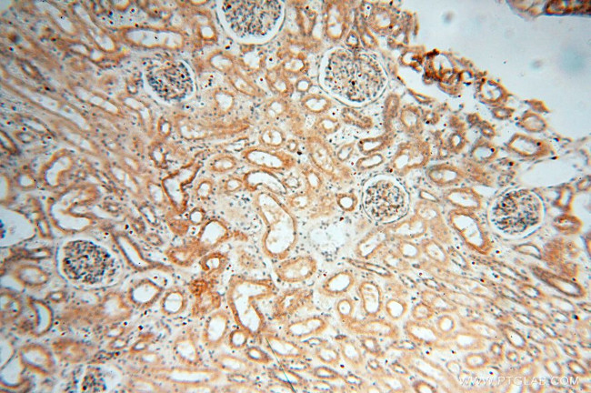 EIF2AK2/PKR Antibody in Immunohistochemistry (Paraffin) (IHC (P))