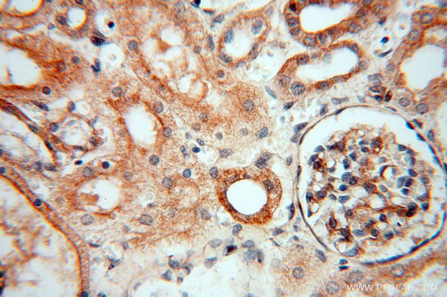 EIF2AK2/PKR Antibody in Immunohistochemistry (Paraffin) (IHC (P))