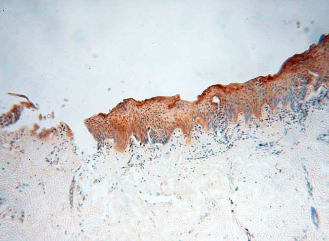 EIF2AK2/PKR Antibody in Immunohistochemistry (Paraffin) (IHC (P))