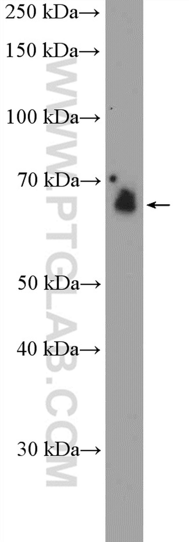 EIF2AK2/PKR Antibody in Western Blot (WB)