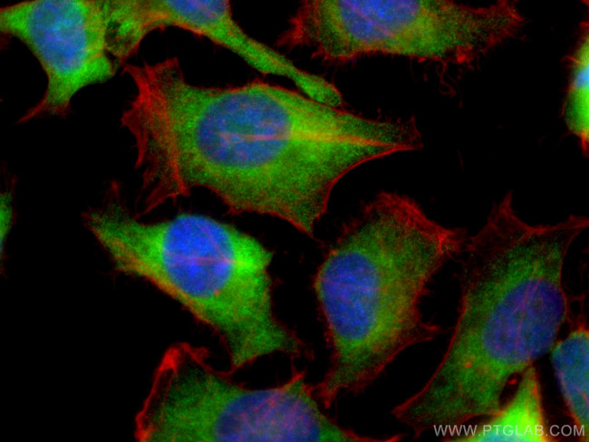 EIF2AK2/PKR Antibody in Immunocytochemistry (ICC/IF)