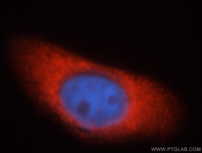 EIF2AK2/PKR Antibody in Immunocytochemistry (ICC/IF)