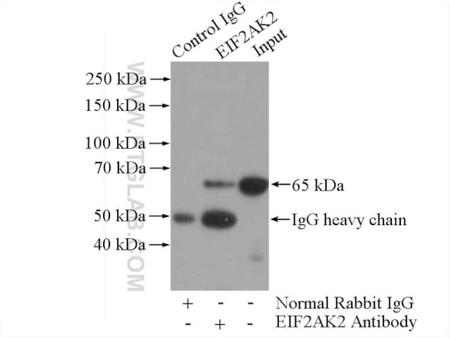 EIF2AK2/PKR Antibody in Immunoprecipitation (IP)