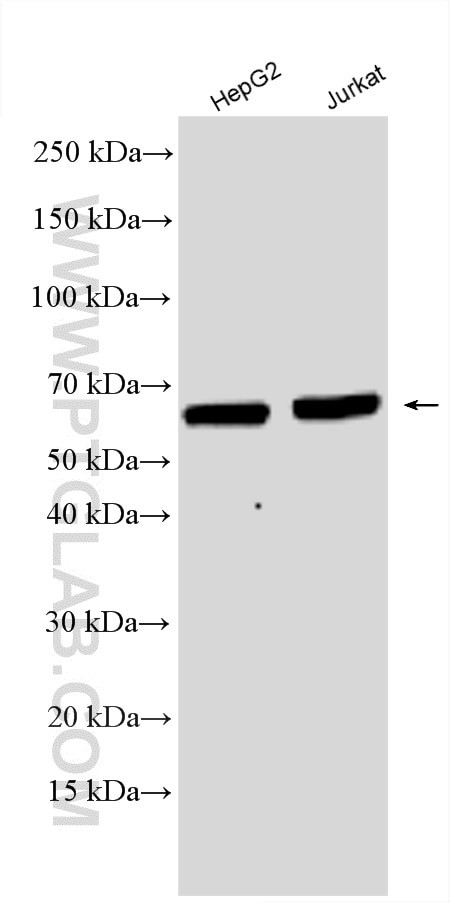 EIF2AK2/PKR Antibody in Western Blot (WB)