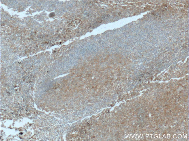 PD-L2/CD273 Antibody in Immunohistochemistry (Paraffin) (IHC (P))