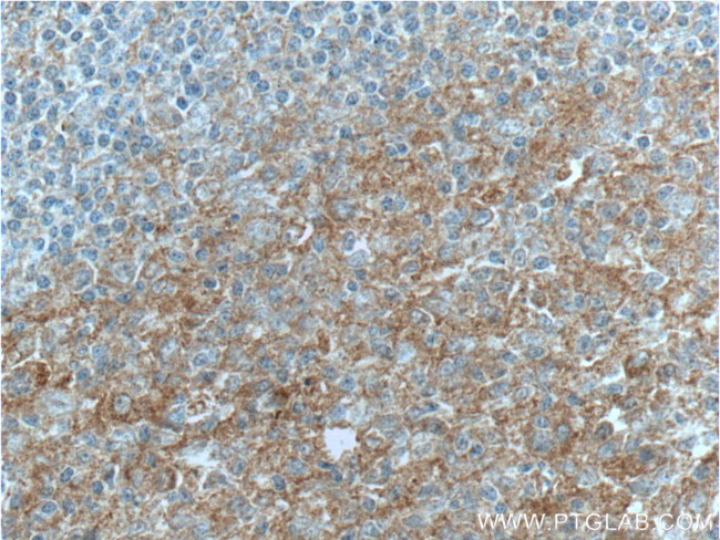 PD-L2/CD273 Antibody in Immunohistochemistry (Paraffin) (IHC (P))