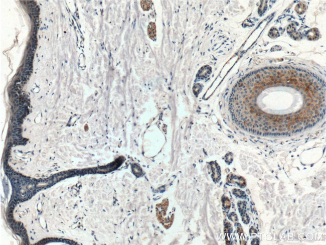 PD-L2/CD273 Antibody in Immunohistochemistry (Paraffin) (IHC (P))