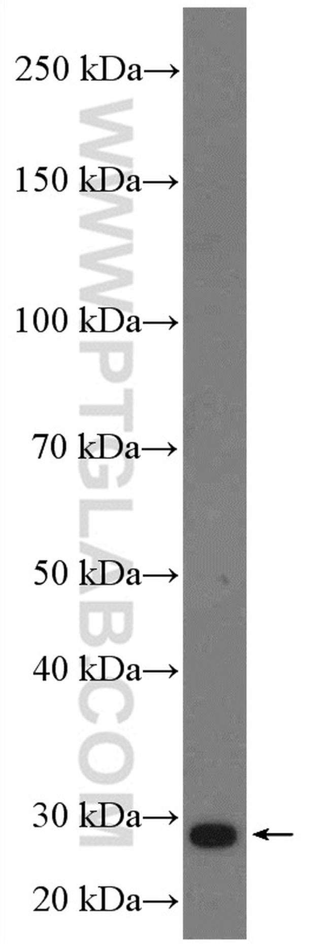 PD-L2/CD273 Antibody in Western Blot (WB)