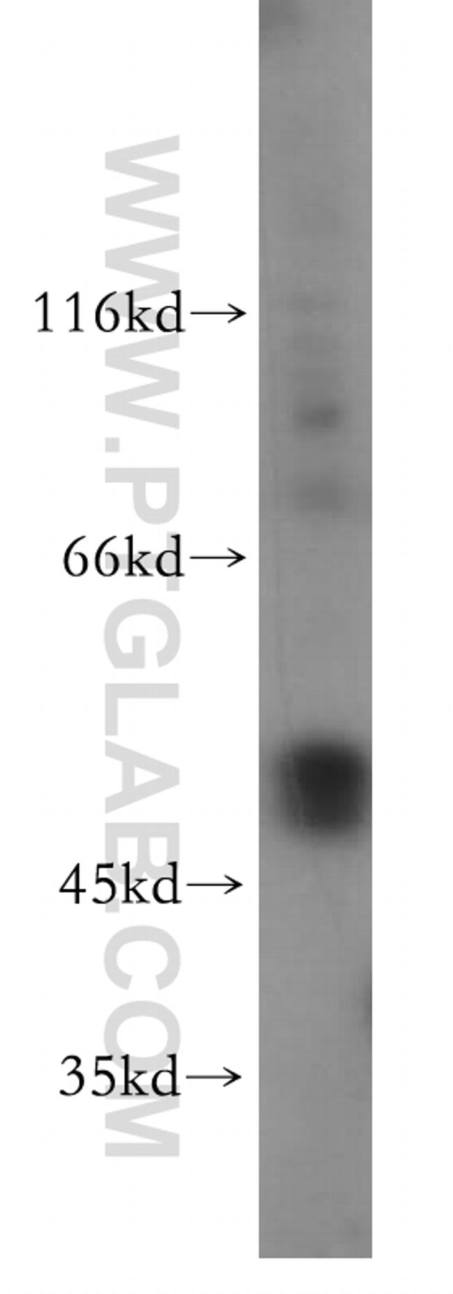 TRMT5 Antibody in Western Blot (WB)