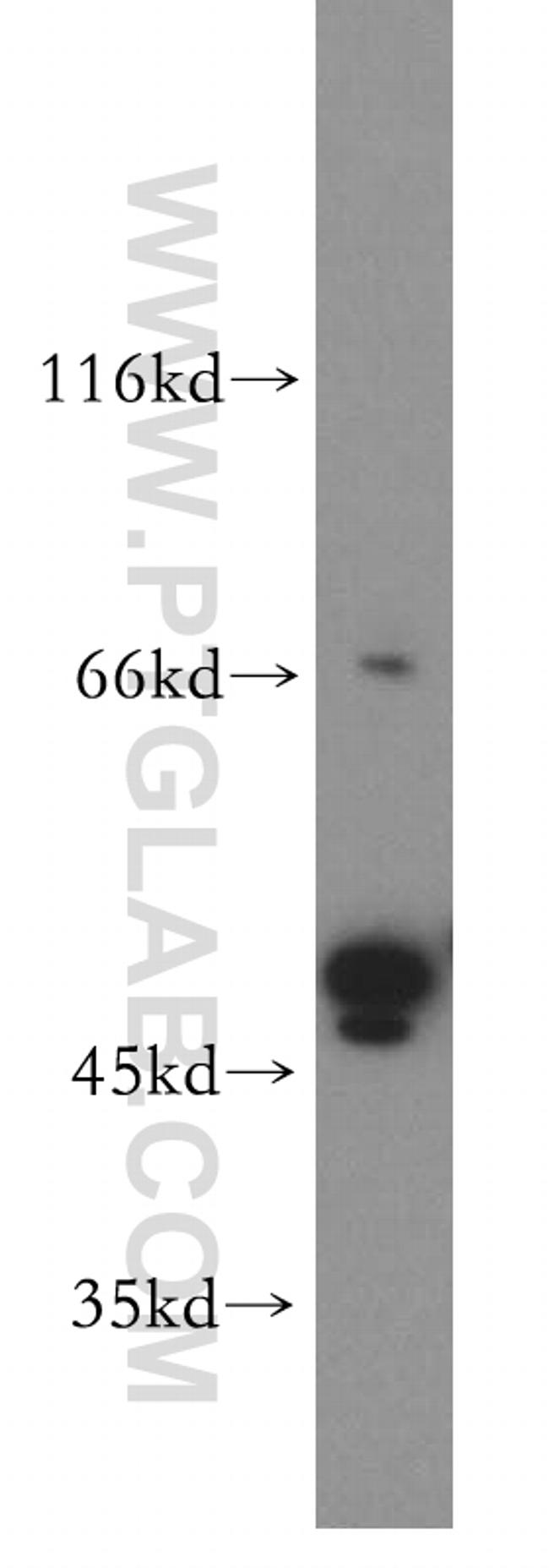 TRMT5 Antibody in Western Blot (WB)