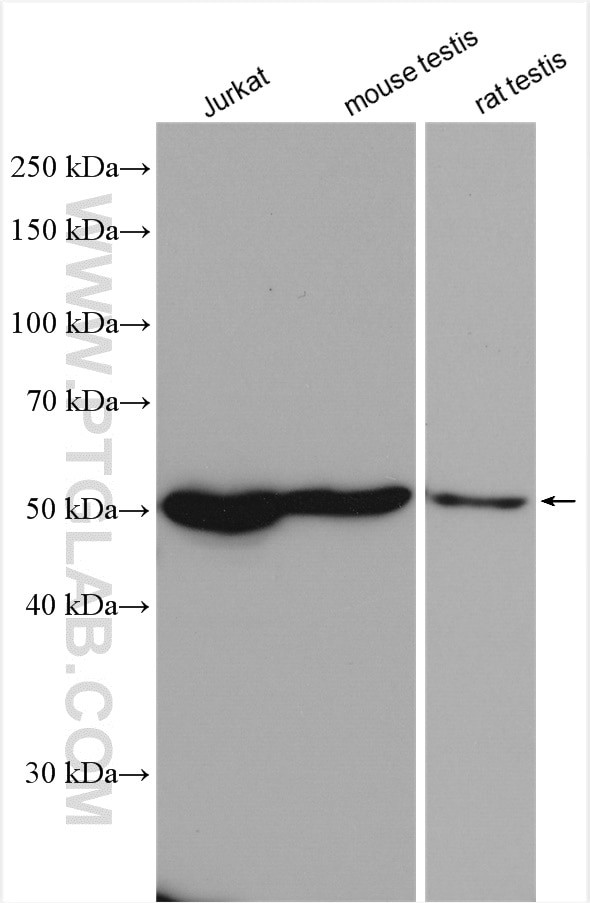 GSR Antibody in Western Blot (WB)