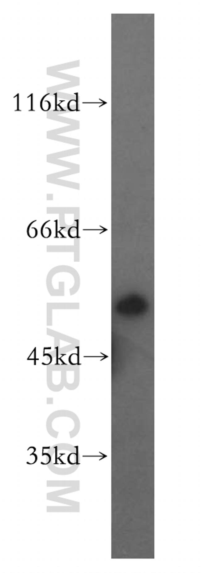 GSR Antibody in Western Blot (WB)