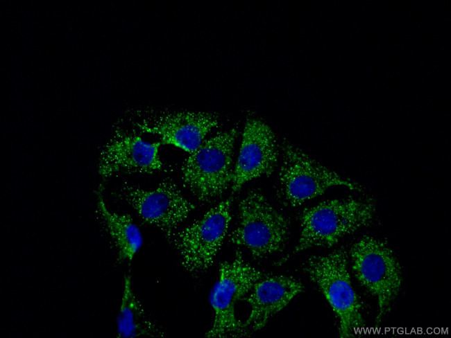 ATG13 Antibody in Immunocytochemistry (ICC/IF)