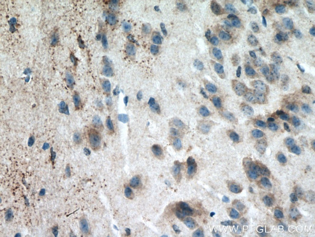 ATG13 Antibody in Immunohistochemistry (Paraffin) (IHC (P))