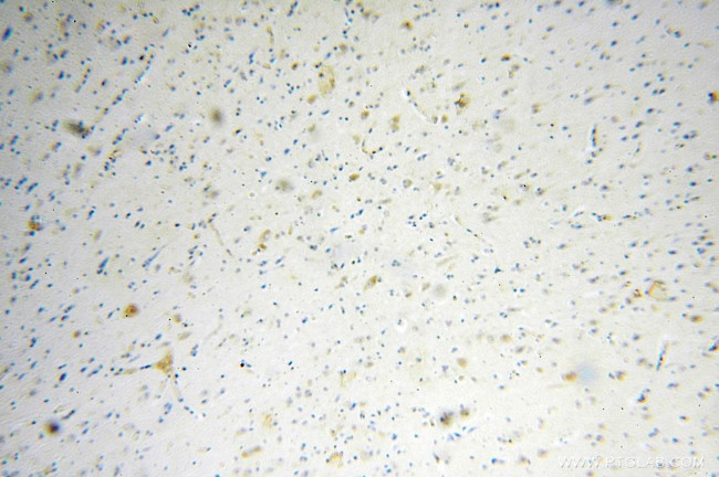 ATG13 Antibody in Immunohistochemistry (Paraffin) (IHC (P))