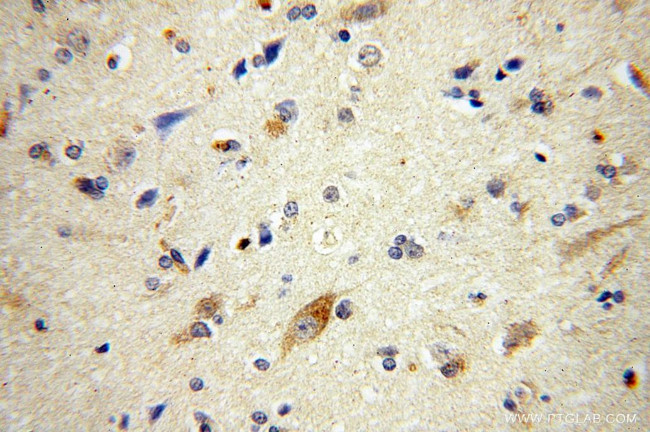 ATG13 Antibody in Immunohistochemistry (Paraffin) (IHC (P))