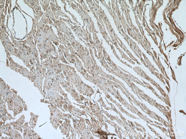 ATG13 Antibody in Immunohistochemistry (Paraffin) (IHC (P))