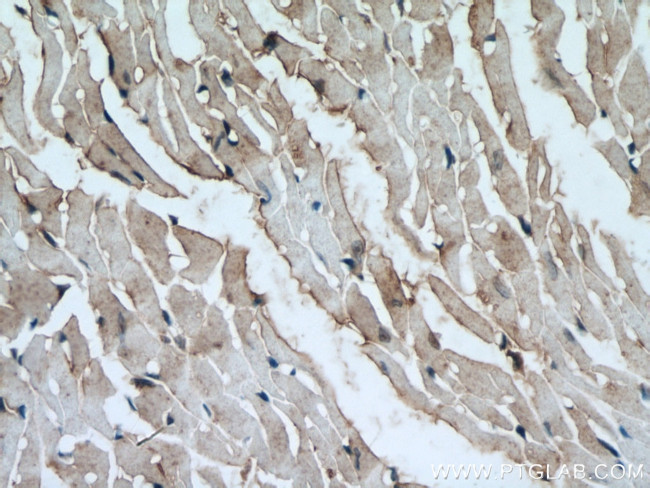 ATG13 Antibody in Immunohistochemistry (Paraffin) (IHC (P))