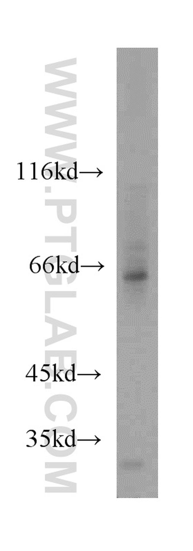 ATG13 Antibody in Western Blot (WB)