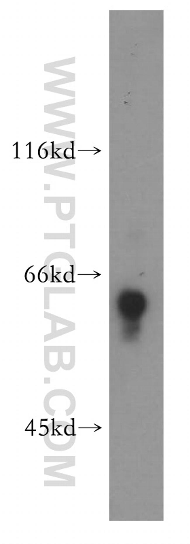 ATG13 Antibody in Western Blot (WB)