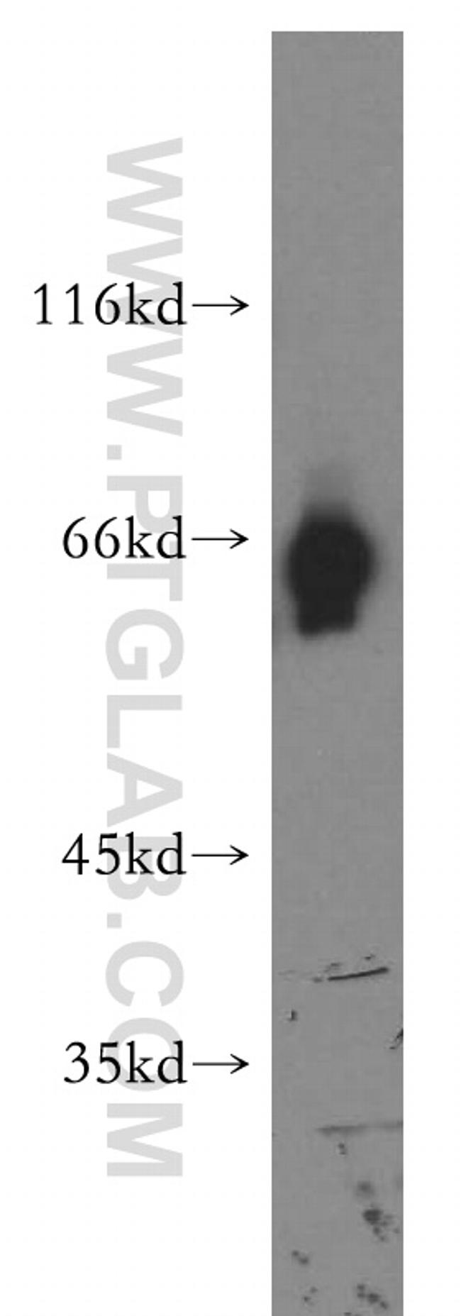 ATG13 Antibody in Western Blot (WB)