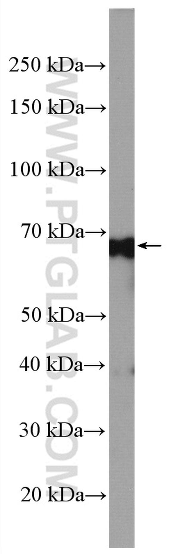 ATG13 Antibody in Western Blot (WB)