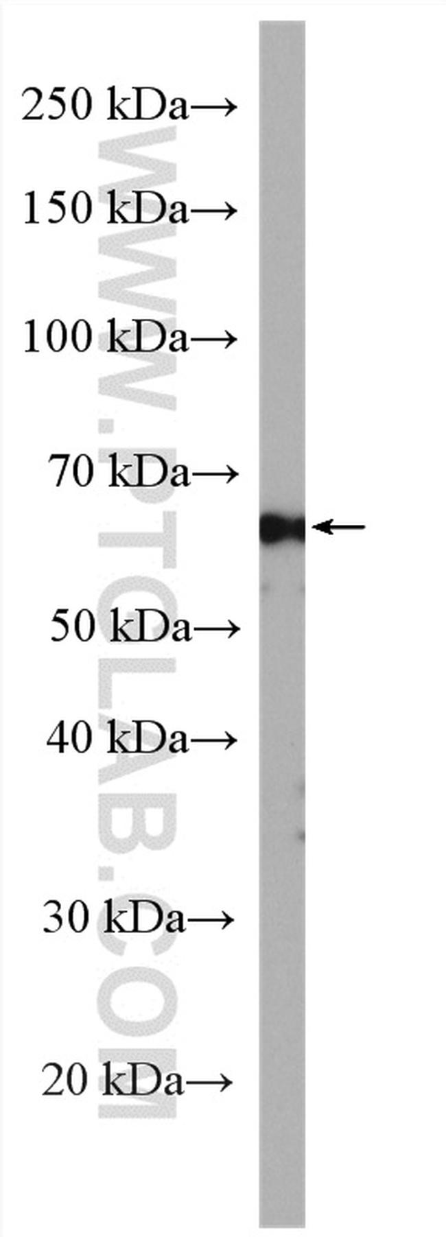 ATG13 Antibody in Western Blot (WB)