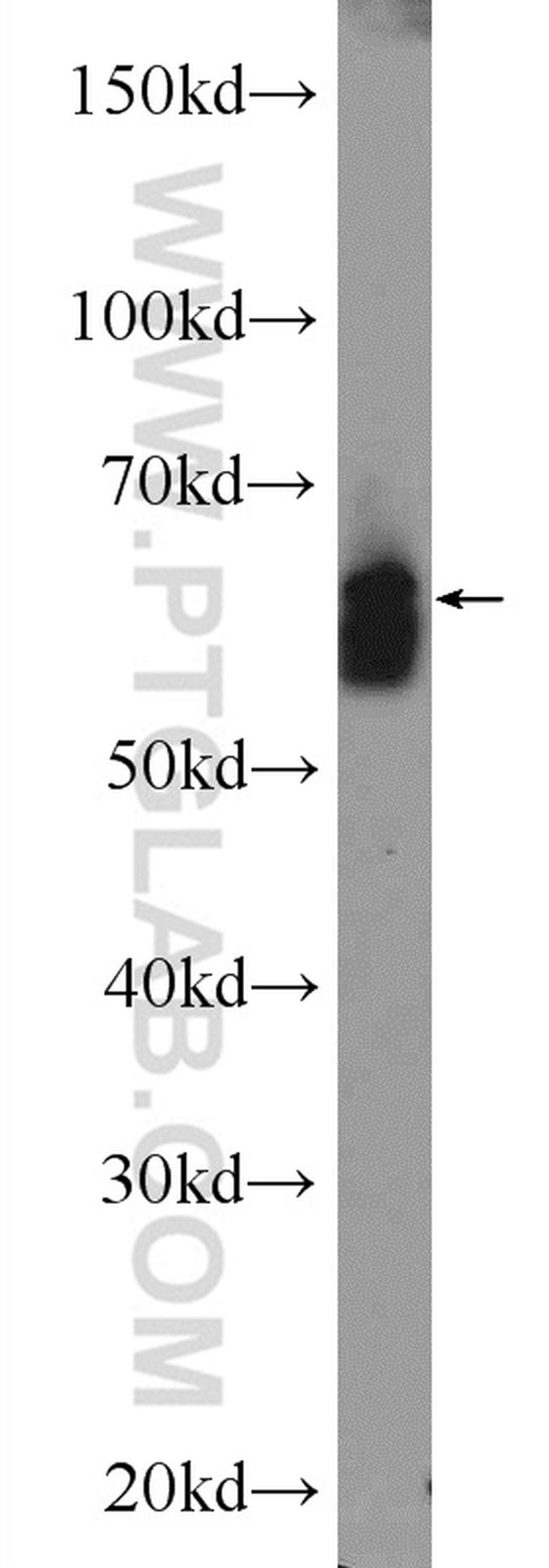ATG13 Antibody in Western Blot (WB)