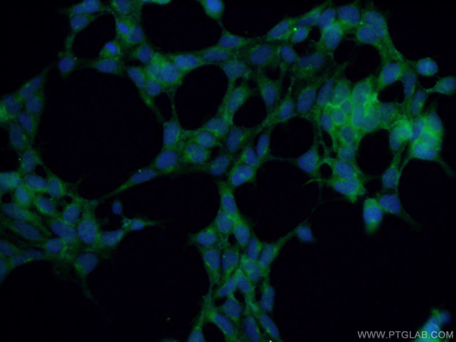 PDK1 Antibody in Immunocytochemistry (ICC/IF)