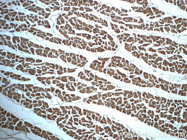 PDK1 Antibody in Immunohistochemistry (Paraffin) (IHC (P))