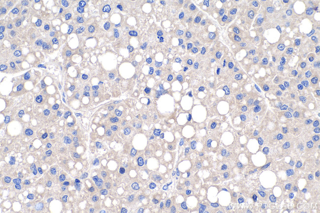 PDK1 Antibody in Immunohistochemistry (Paraffin) (IHC (P))