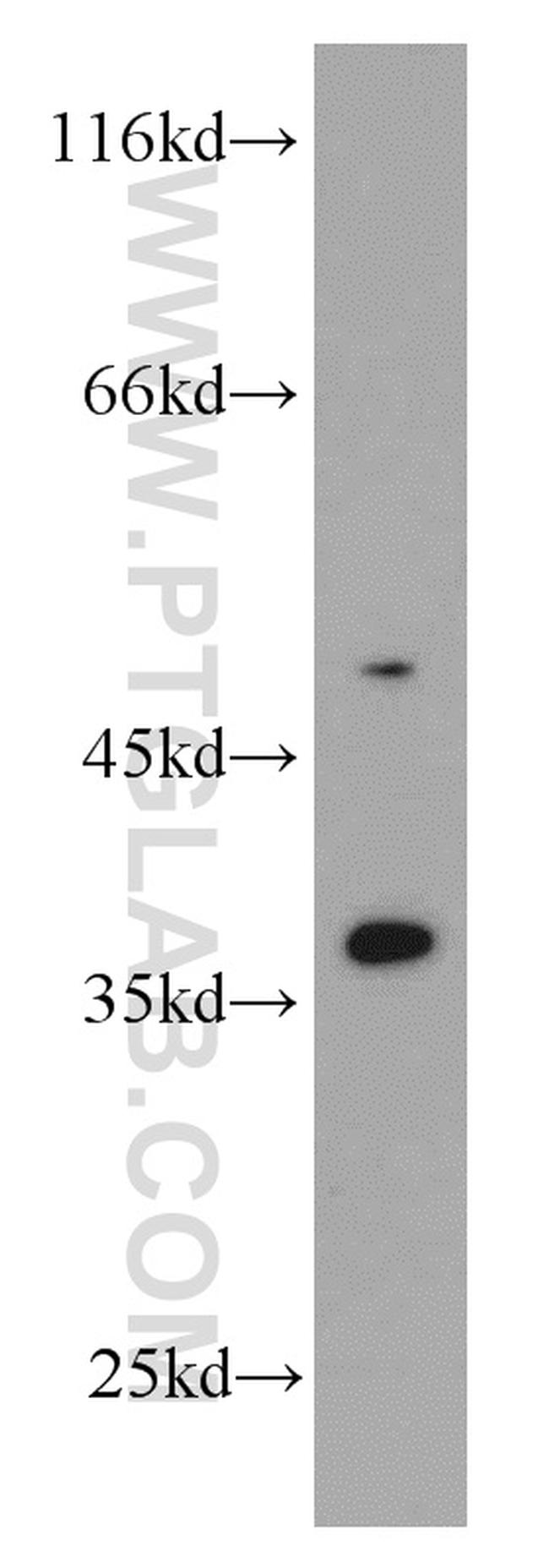 PDK1 Antibody in Western Blot (WB)