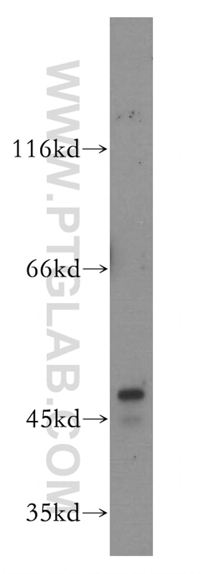 PDK1 Antibody in Western Blot (WB)