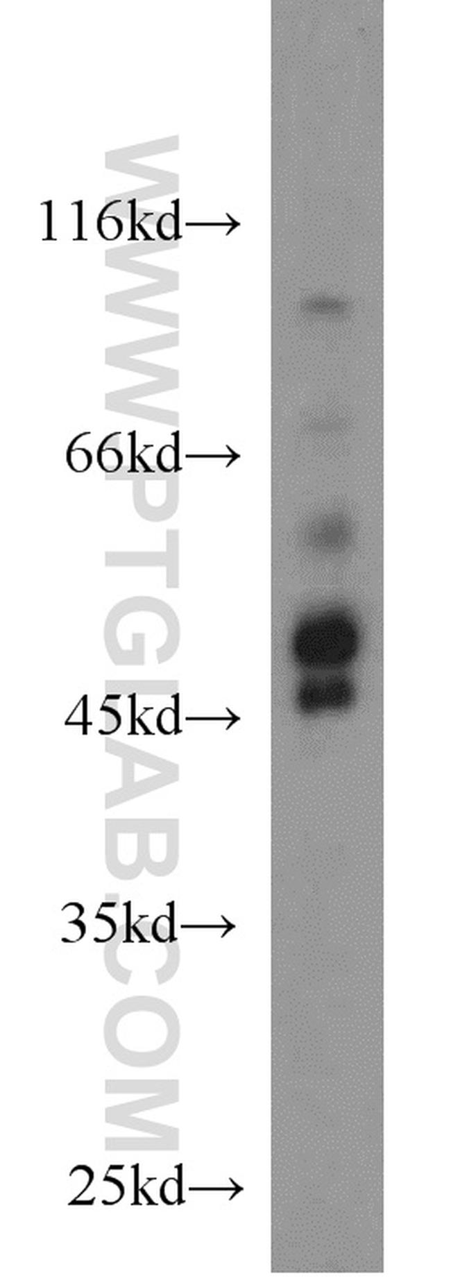 PDK1 Antibody in Western Blot (WB)