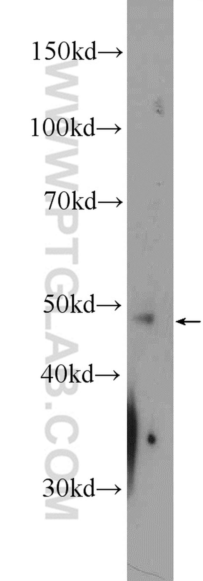 PDK1 Antibody in Western Blot (WB)