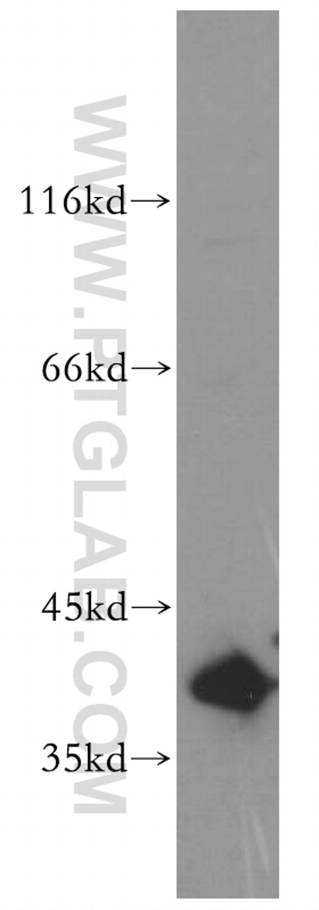 PHLDA1 Antibody in Western Blot (WB)