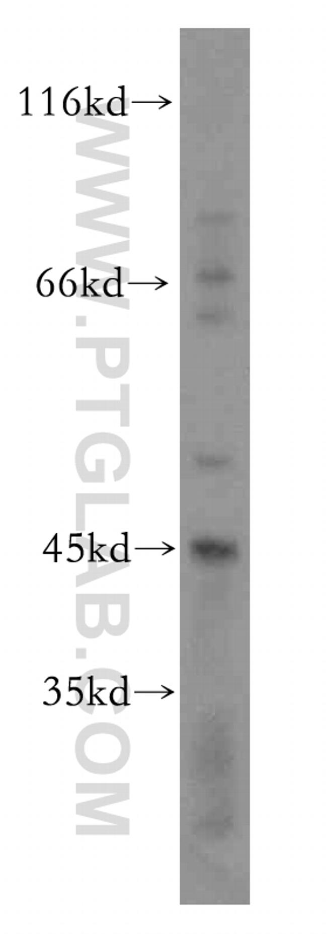 PHLDA1 Antibody in Western Blot (WB)