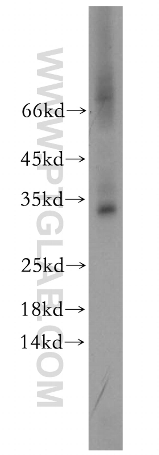 C2orf49 Antibody in Western Blot (WB)