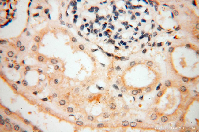 P2RY1 Antibody in Immunohistochemistry (Paraffin) (IHC (P))