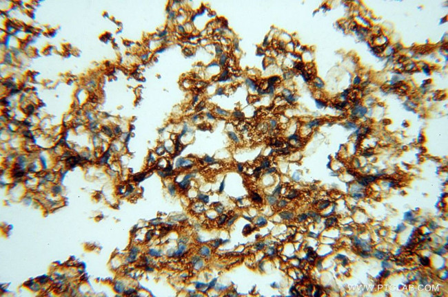 P2RY1 Antibody in Immunohistochemistry (Paraffin) (IHC (P))